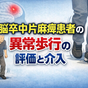 リピート配信　脳卒中片麻痺患者の異常歩行の評価と介入 ～分回し歩行・反張膝・麻痺側荷重時間短縮・立脚時体幹側屈を中心に～（122分）（2026年8月31日まで視聴可能）